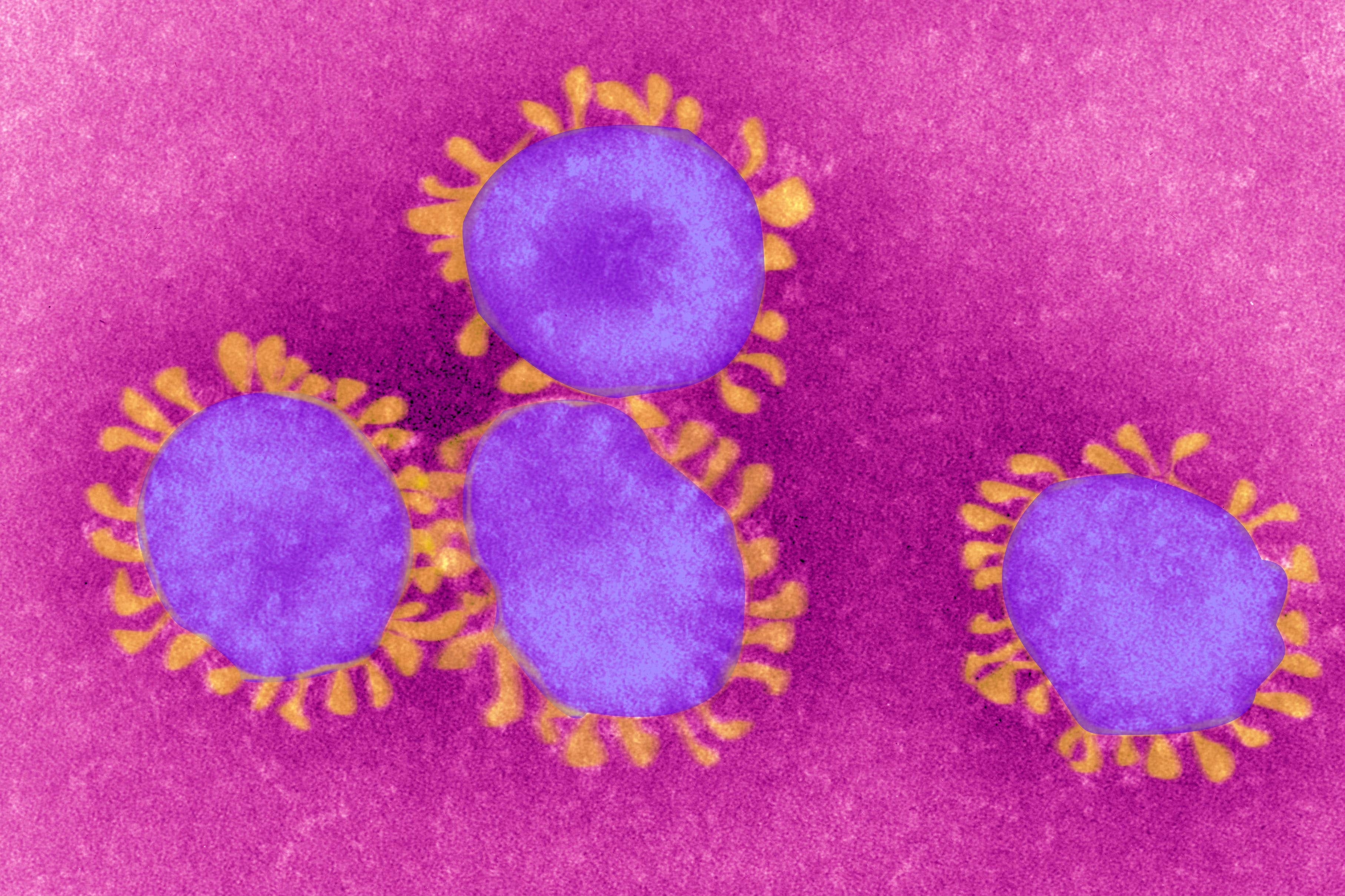 The coronavirus owes its name to the crown-like projections that encircle the capsid.