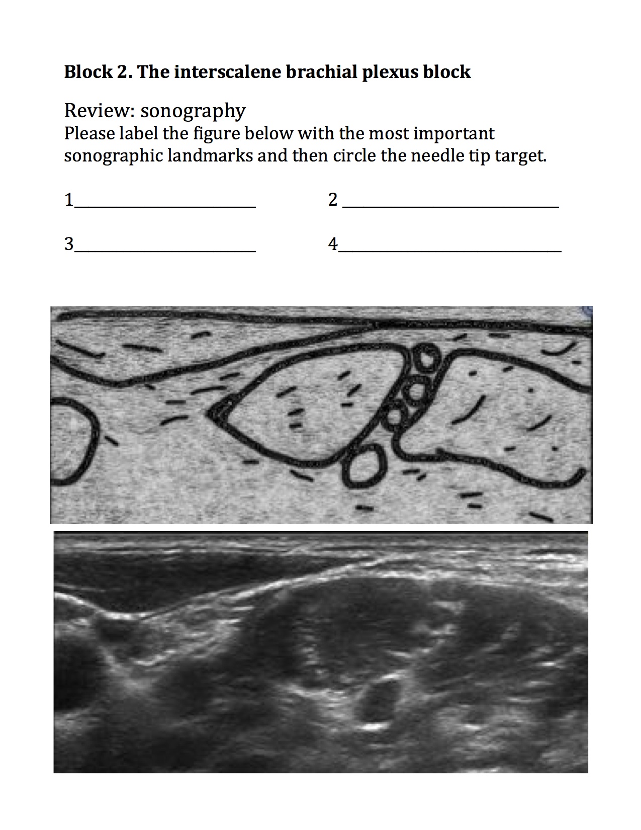 13_Insterscalene.workbook.jpg