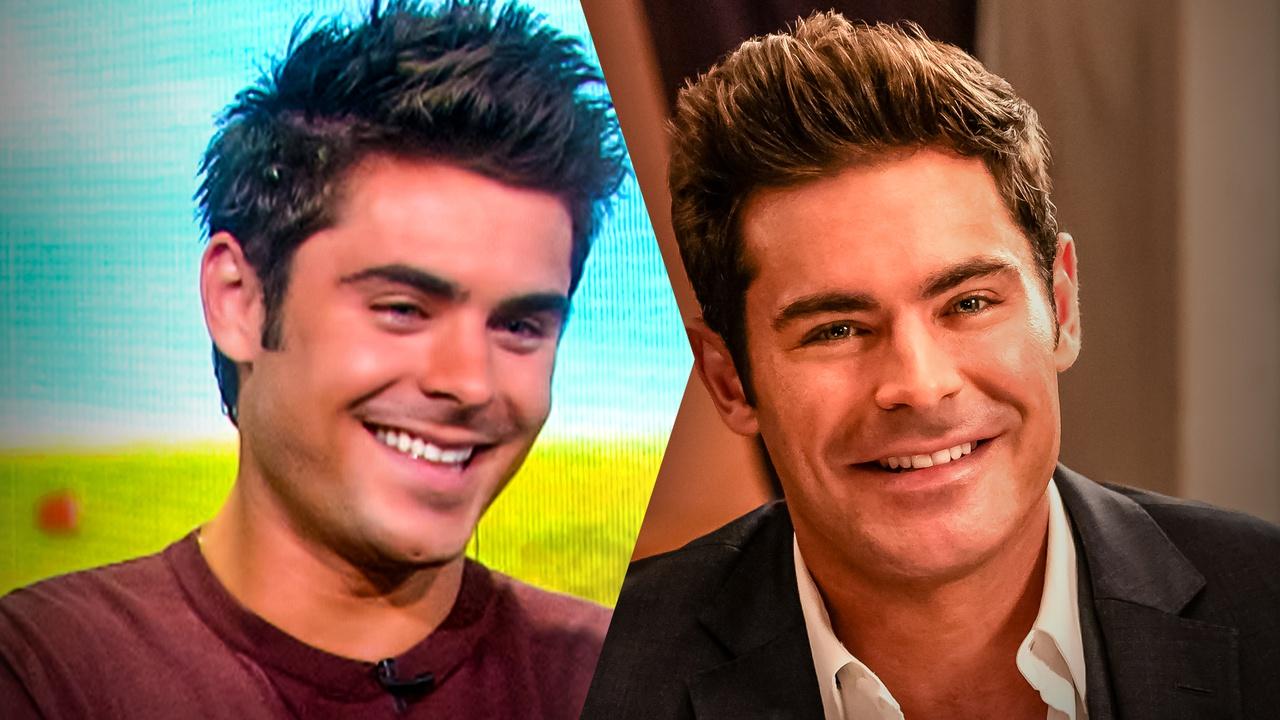 Zac Efron face before and after surgery for jaw