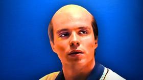 Why Was Lyle Menendez Bald When Young? Monsters Netflix Wig Portrayal Vs. Real-Life