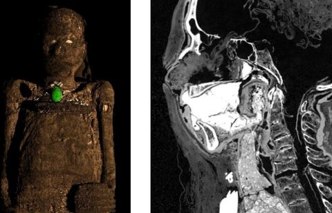 Pourquoi la momie Séramon, vieille de 3.000 ans, va être hospitalisée à Lyon ?