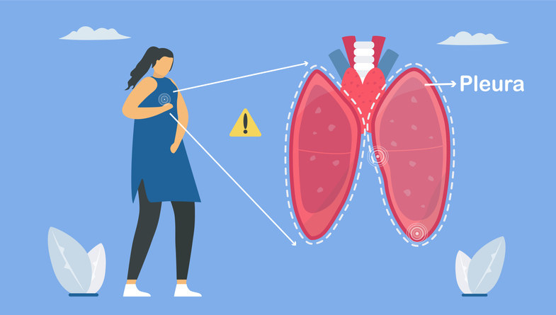 Pulmonology vector illustration about restrictive lung disease showing pleurisy, a condition in which the pleura that separates lungs from chest wall becomes inflamed