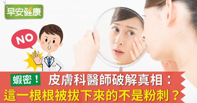 皮膚科醫師破解真相：這一根根被拔下來的不是粉刺？