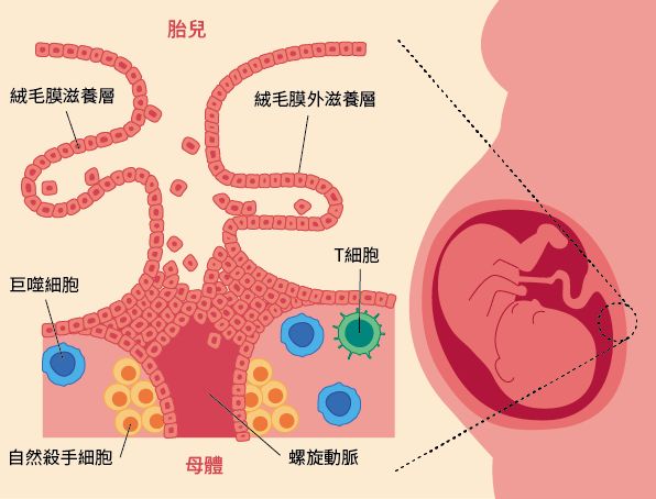 免疫性流產是怎麼發生的？