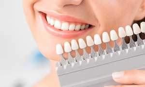 Up to 72% Off at Natural White Advanced Teeth Whitening