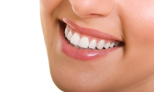 Up to 99% Off Invisalign at SouthEnd Dentistry