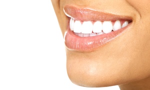 77% Off Take-Home Teeth-Whitening Kit