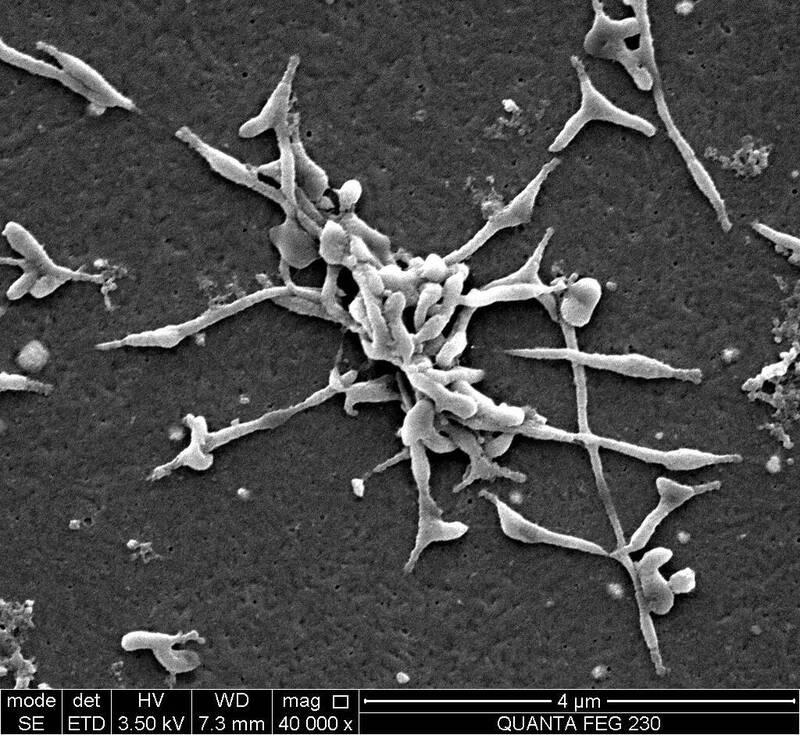 赴日注意！ 日本染「肺炎黴漿菌」患者增 連2週創新高