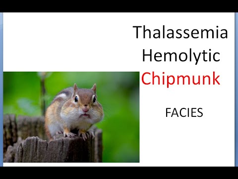 Why is chipmunk face in beta thalassemia? – Tipseri