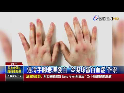 遇冷手腳急凍發白冷凝球蛋白血症作祟