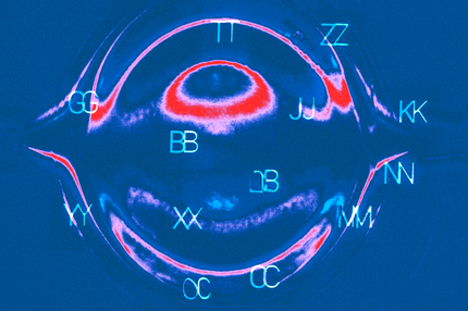 OpenAI o1: Wir sind einfach zu dumm, die richtigen Fragen zu stellen