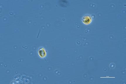 Fischsterben durch Goldalgen: Die kleine Alge nimmersatt. "Prymnesium parvum", vergrößert unter dem Mikroskop.