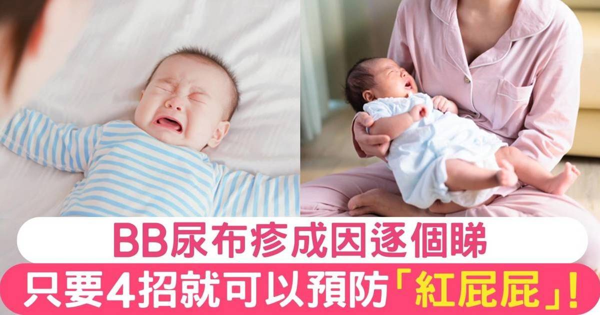 尿布疹如何應對？4大類型成因+預防及治療方法逐個睇！