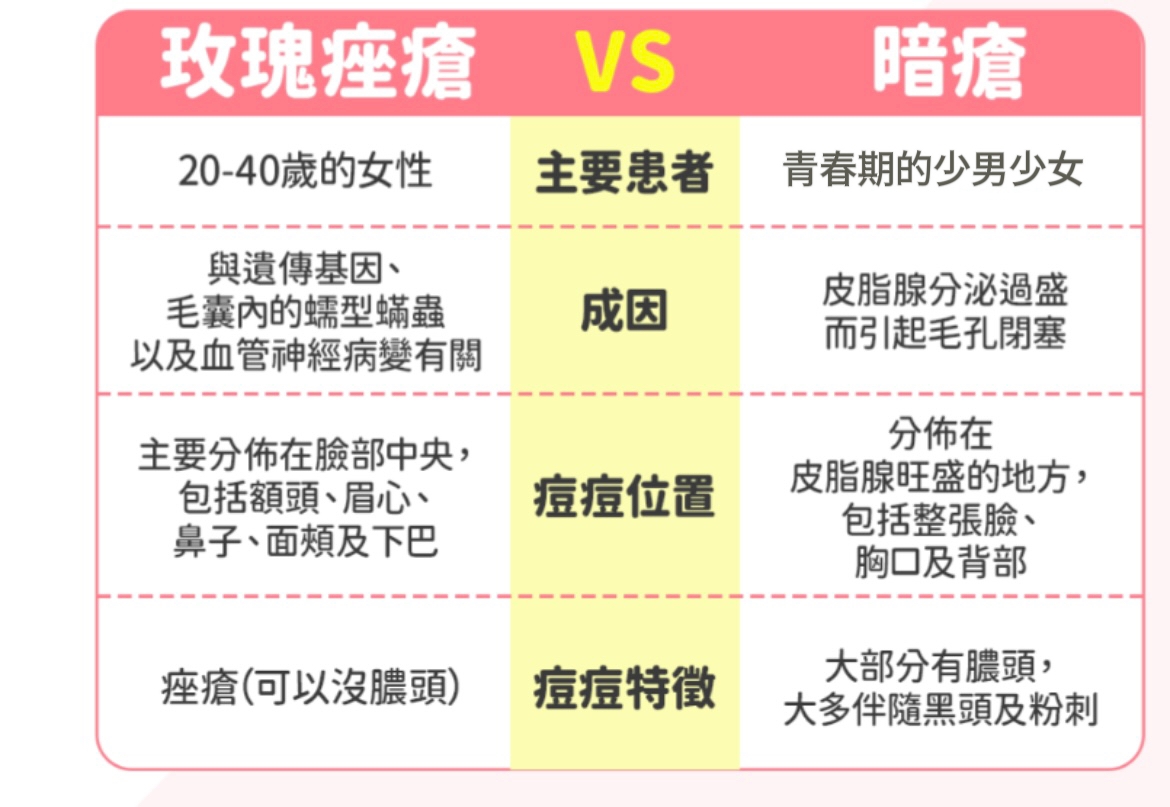 玫瑰痤瘡成因徵狀及治療方法！醫生解構玫瑰痤瘡不等於暗瘡、紅斑狼瘡及皮膚敏感！