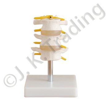 3 Piece Lumbar Model or Vertebrae Model