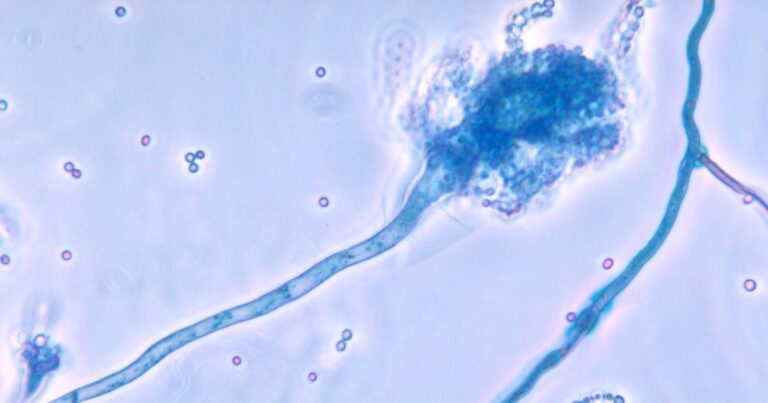 Imagem de microscopia de esporo de do fungo Aspergillus fumigatus com uma cabeça arredondada e uma espécie de cauda, tingidos de azul