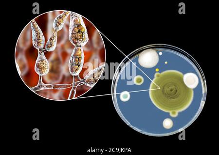 Filamentous allergenic fungus Alternaria alternata, computer illustration of fungal morphology and photograph of fungal colonies on Sabouraud Dextrose Stock Photo