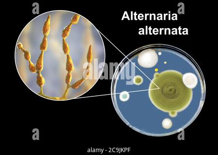 Filamentous allergenic fungus Alternaria alternata, computer illustration of fungal morphology and photograph of fungal colonies on Sabouraud Dextrose Stock Photo