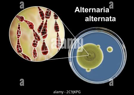 Filamentous allergenic fungus Alternaria alternata, computer illustration of fungal morphology and photograph of fungal colonies on Sabouraud Dextrose Stock Photo