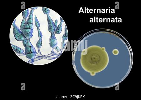 Filamentous allergenic fungus Alternaria alternata, computer illustration of fungal morphology and photograph of fungal colonies on Sabouraud Dextrose Stock Photo