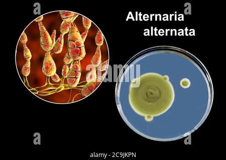 Filamentous allergenic fungus Alternaria alternata, computer illustration of fungal morphology and photograph of fungal colonies on Sabouraud Dextrose Stock Photo