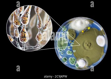 Filamentous allergenic fungus Alternaria alternata, computer illustration of fungal morphology and photograph of fungal colonies on Sabouraud Dextrose Stock Photo