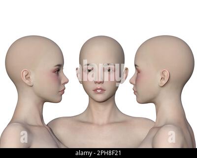 3d render. And the angle of a female bald head on a white background. Stock Photo