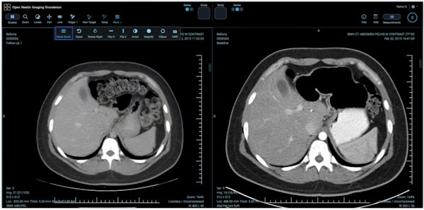 Découvrez comment stocker, récupérer et analyser des données d'imagerie médicale à l'aide de l'API Cloud Healthcare