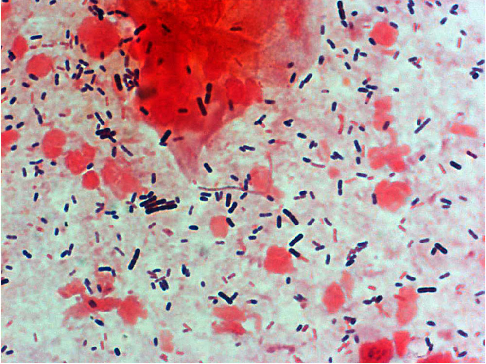 File:Bacteria - gram-stained vaginal smear 05.jpg - Embryology