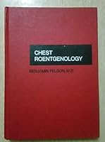 Chest Roentgenology