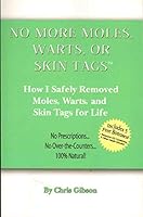 NO MORE MOLES WARTS OR SKIN TAGS! How I Safely Removed Moles, Warts, and Skin Tags for Life