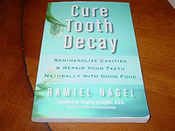 Paperback Cure Tooth Decay: Heal and Prevent Cavities with Nutrition, 2nd Edition Book