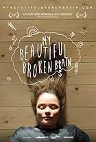 My Beautiful Broken Brain (2014)