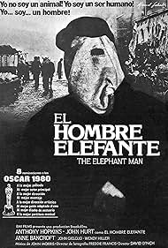 John Hurt in El hombre elefante (1980)