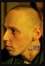 Ewen Bremner in Skin (1995)