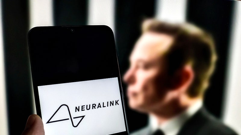 Cosa sappiamo del secondo chip Neuralink impiantato nel cervello di un essere umano