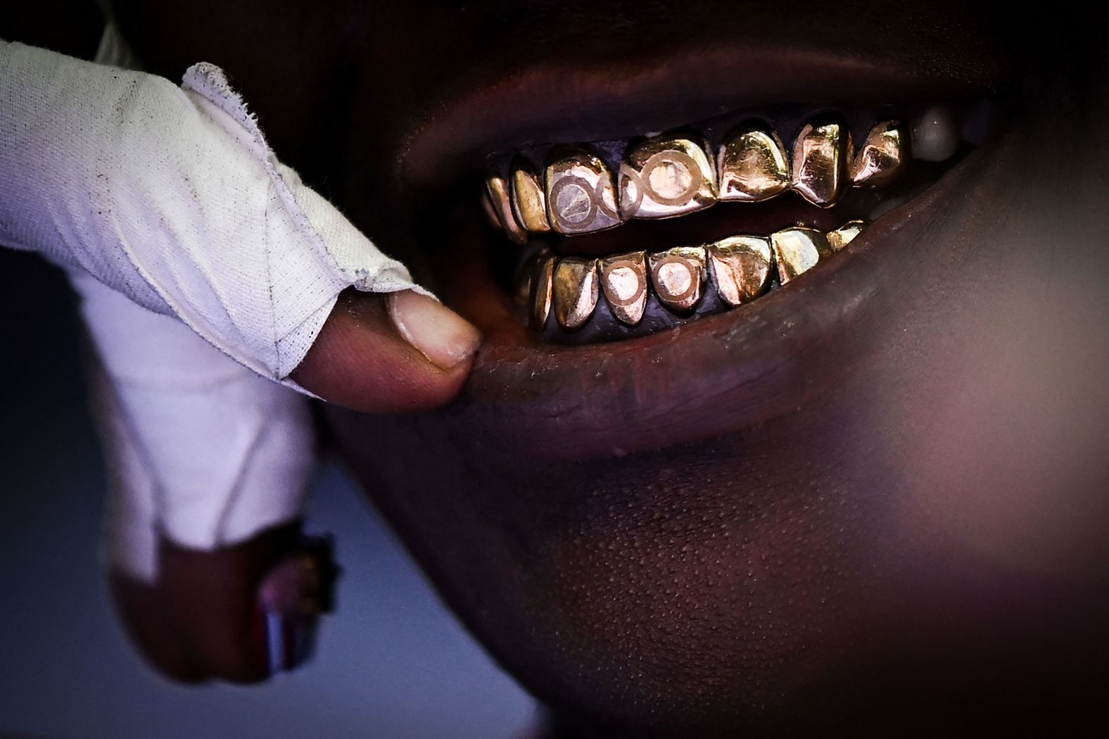 American shot putter Raven Saunders wears gold Olympic-themed grills on August 8. <a href="https://www.cnn.com/sport/live-news/paris-olympics-news-2024-08-08#h_9ff634d1208f4fe2de266cea626f097e">Saunders also donned a black face mask and colorful visor sunglasses</a> while competing. Saunders later said the outfit was all about inspiring people to be themselves.