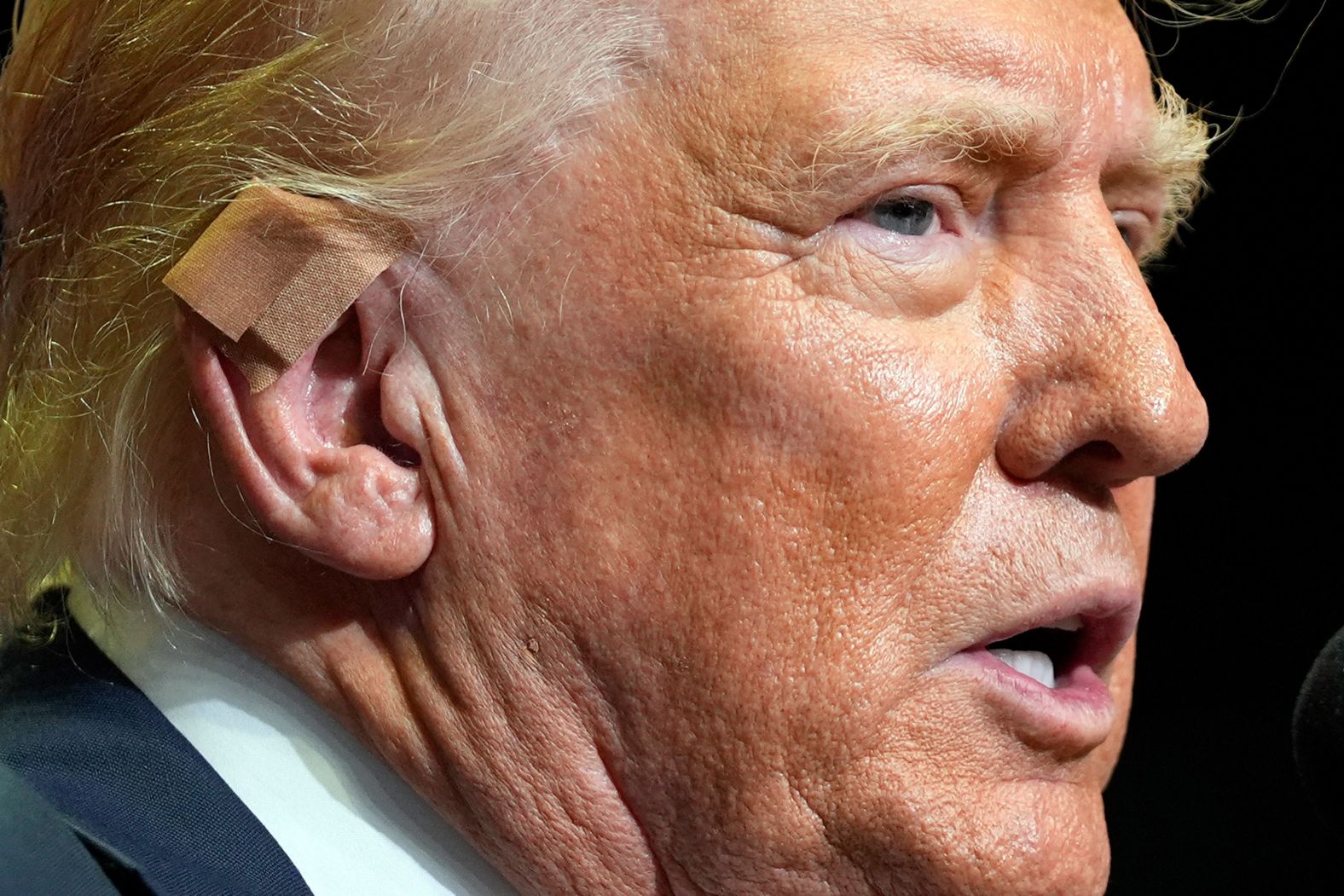 A bandage is seen on the right ear of former US President Donald Trump as he speaks at a campaign rally in Grand Rapids, Michigan, on Saturday, July 20. Trump’s ear was shot during an <a href="https://www.cnn.com/2024/07/13/politics/gallery/in-pictures-trump-injured-at-pennsylvania-rally/index.html">assassination attempt</a> earlier this month.