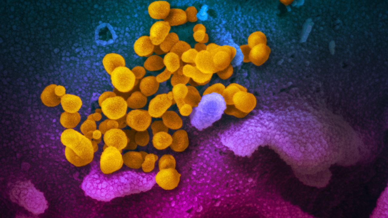 This scanning electron microscope image shows SARS-CoV-2 (yellow)—also known as 2019-nCoV, the virus that causes COVID-19—isolated from a patient in the U.S., emerging from the surface of cells (blue/pink) cultured in the lab. Credit: NIAID-RML