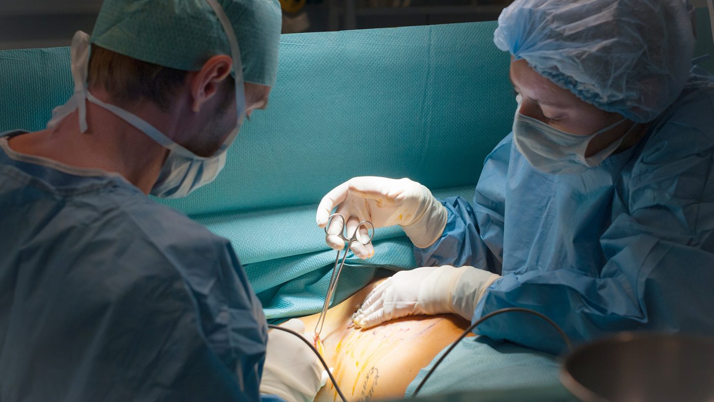 Breast implant surgery