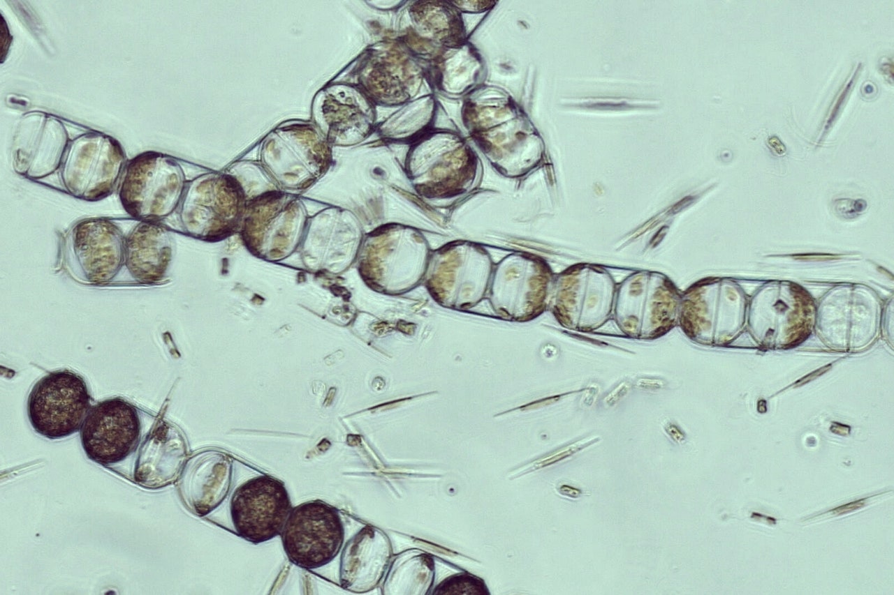 A Critical Arctic Organism Is Now Infested With Microplastics