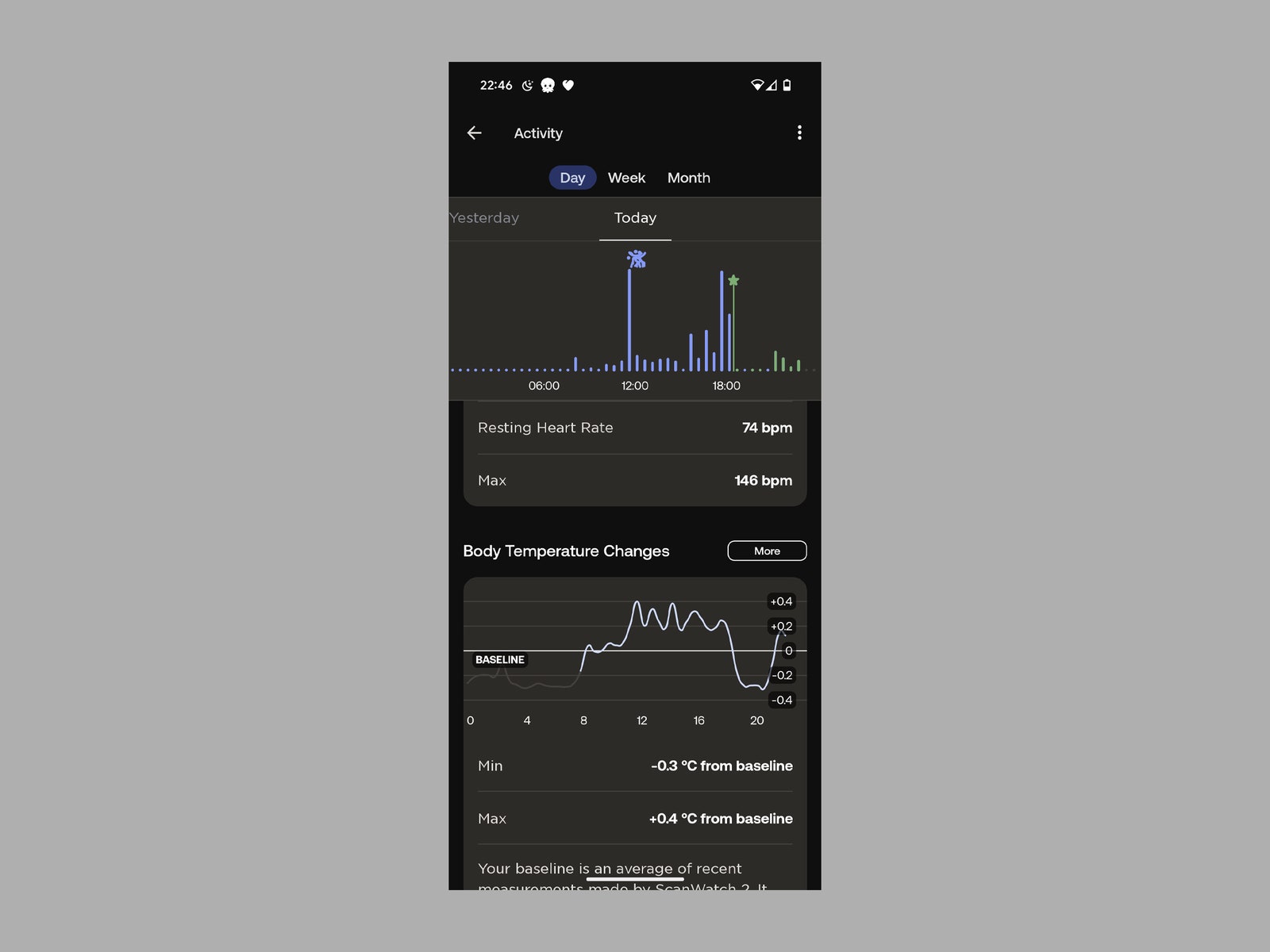 Screenshot of the Withings ScanWatch app