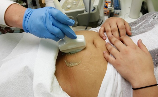 A woman gets a sonogram in an Austin clinic.