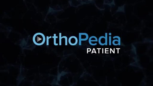 Arthrex Launches Online Learning Tool for Orthopedic Patients