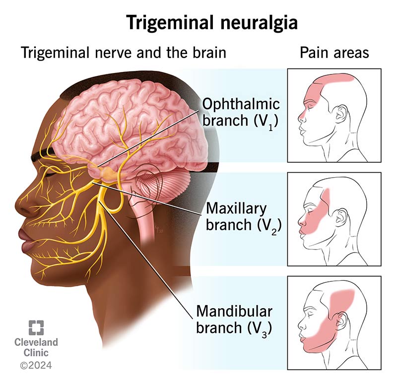 The trigeminal nerve and its branches in the human head and face