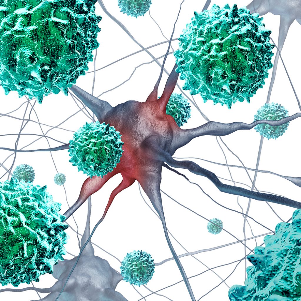 Polio like AFM disease or acute flaccid myelitis medical concept as a neurologic condition representing enterovirus or virus illness as a 3D illustration on a white background.