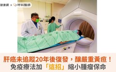 肝癌未追蹤20年後復發，釀嚴重黃疸！免疫療法加「這招」縮小腫瘤保命