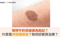 咖啡牛奶斑被誤為胎記？什麼是神經纖維瘤？如何診斷與治療？