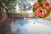 A 14-year-old boy in India died Thursday from an infection caused by a brain-eating amoeba he contracted while swimming in contaminated water.