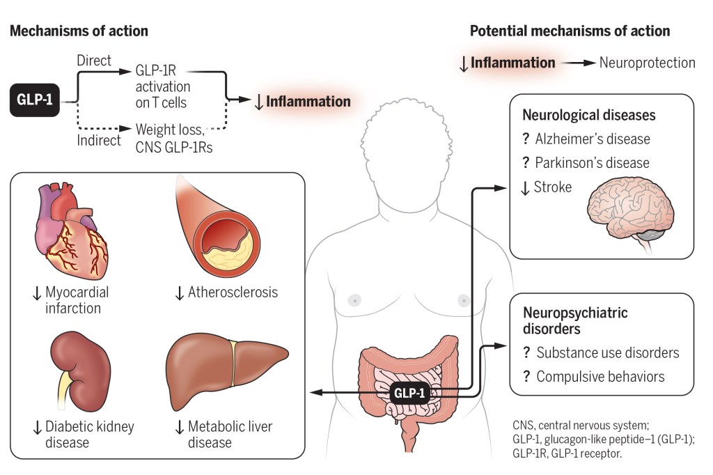 Here are some potential uses for Ozempic, like treating Alzheimer's disease and substance abuse.